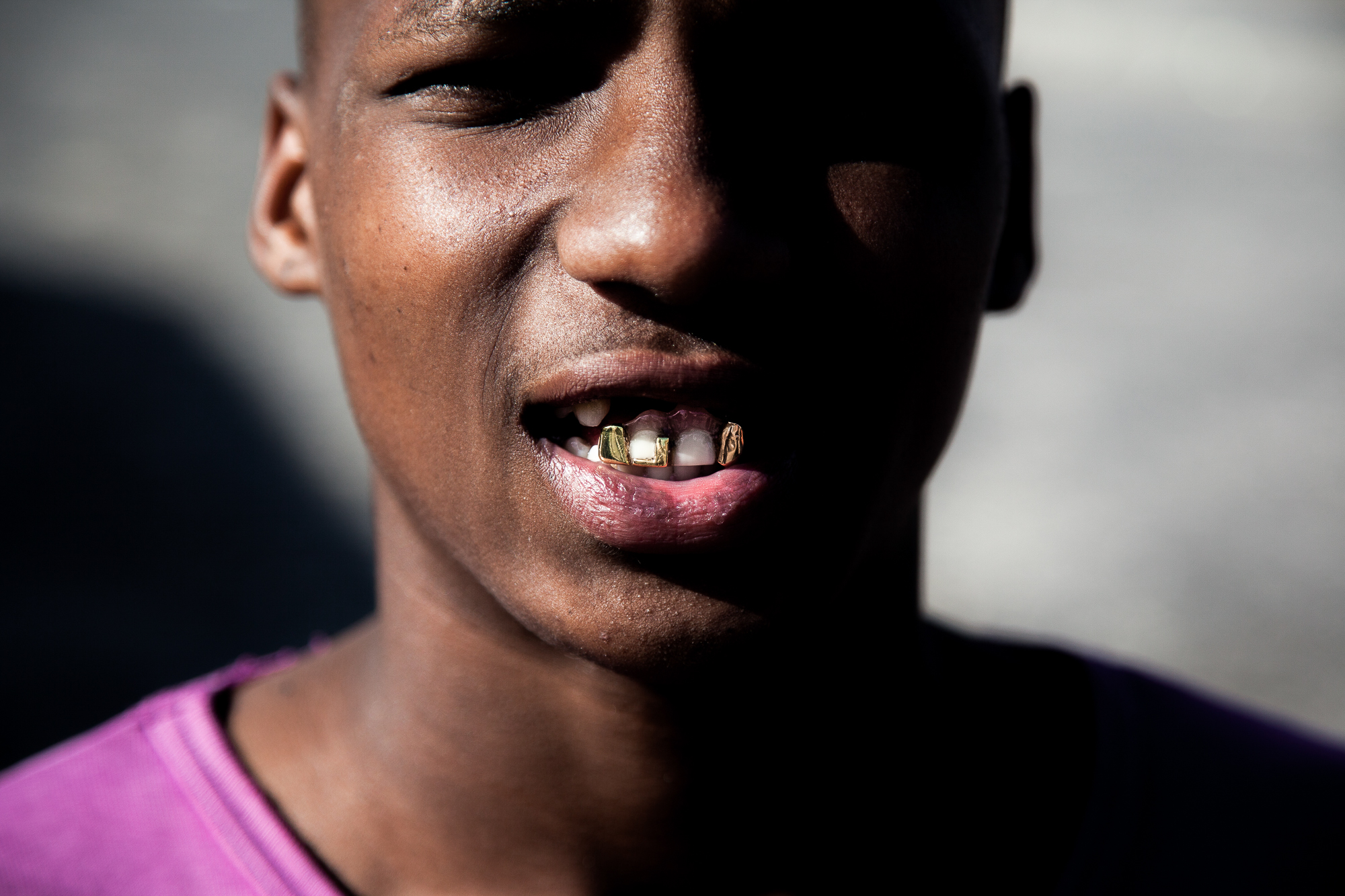 Passion Gap Cape Flats portrait showing dental modification